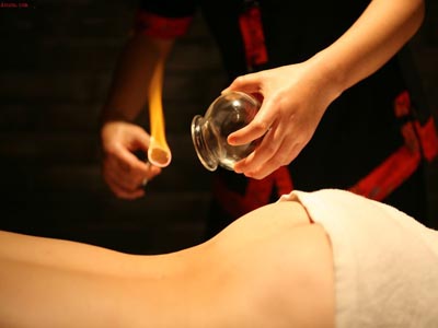fire cupping method